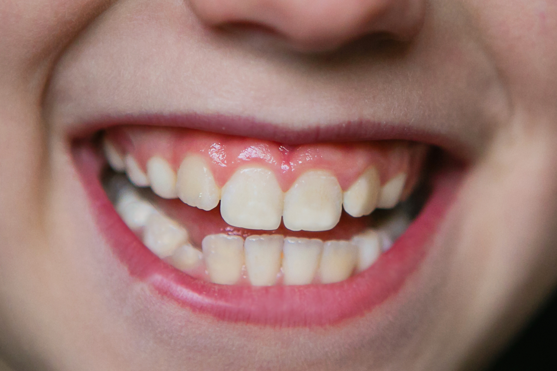 Teeth and dental care | TheSchoolRun